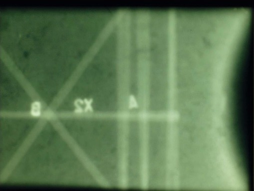 Obrzek 2b.: Detail radiogramu kde je zjevn absence kruhov vztue s radilnmi pruty.