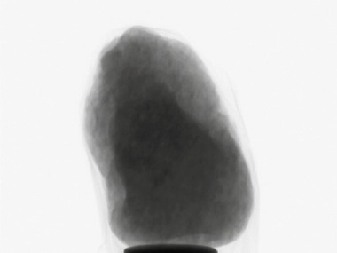 Obr. 2a Pklad projekc (2D RTG snmk) zrna kameniva pozench v hlu 90. Projekce pro standardn tomografii s rozlienm 14,96 μm / pixel.
